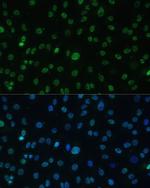 HSF1 Antibody in Immunocytochemistry (ICC/IF)