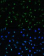HSF1 Antibody in Immunocytochemistry (ICC/IF)
