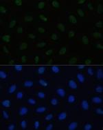 HSF1 Polyclonal Antibody