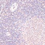 HSF1 Antibody in Immunohistochemistry (Paraffin) (IHC (P))