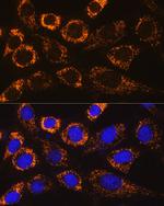 P4HA3 Polyclonal Antibody