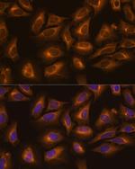 KARS Polyclonal Antibody