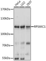 RPS6KC1 Polyclonal Antibody