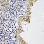 GCC2 Polyclonal Antibody