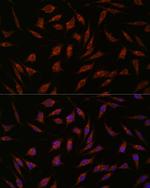 NXT2 Antibody in Immunocytochemistry (ICC/IF)
