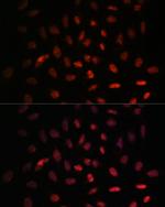 NXT2 Antibody in Immunocytochemistry (ICC/IF)