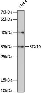 STX10 Antibody in Western Blot (WB)
