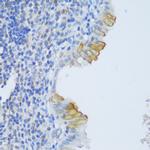 EFCAB4B Polyclonal Antibody