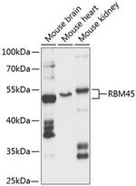 DRB1 Polyclonal Antibody