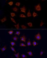CPT1C Polyclonal Antibody