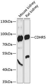 CDHR5 Polyclonal Antibody