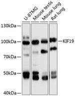 KIF19 Polyclonal Antibody