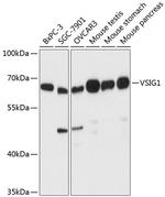 VSIG1 Polyclonal Antibody