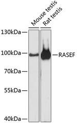 RASEF Polyclonal Antibody