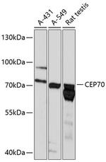 BITE Polyclonal Antibody