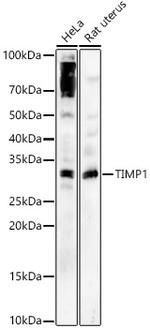 TIMP1 Antibody in Western Blot (WB)