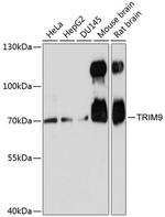 TRIM9 Polyclonal Antibody