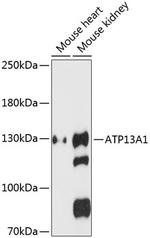 ATP13A1 Antibody in Western Blot (WB)
