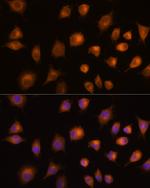 PKM2 Antibody in Immunocytochemistry (ICC/IF)