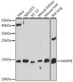 VAMP8 Polyclonal Antibody