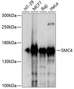 SMC4 Polyclonal Antibody