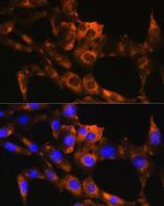 APRT Polyclonal Antibody