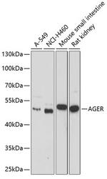 RAGE Antibody in Western Blot (WB)