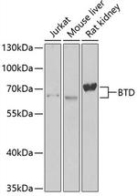 BTD Polyclonal Antibody