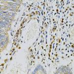 CDA Antibody in Immunohistochemistry (Paraffin) (IHC (P))