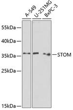 Stomatin Polyclonal Antibody