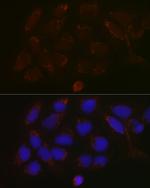 GALNT3 Polyclonal Antibody