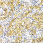 HLA-DPB1 Antibody in Immunohistochemistry (Paraffin) (IHC (P))