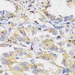 HLA-DPB1 Antibody in Immunohistochemistry (Paraffin) (IHC (P))