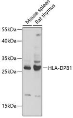 HLA-DPB1 Antibody in Western Blot (WB)