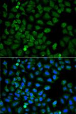 HSC70 Antibody in Immunocytochemistry (ICC/IF)