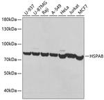HSC70 Antibody in Western Blot (WB)
