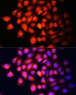 IGF2 Antibody in Immunocytochemistry (ICC/IF)