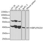 EBP1 Polyclonal Antibody