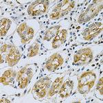 Maspin Antibody in Immunohistochemistry (Paraffin) (IHC (P))