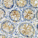 Maspin Antibody in Immunohistochemistry (Paraffin) (IHC (P))