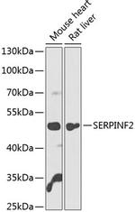 SERPINF2 Polyclonal Antibody