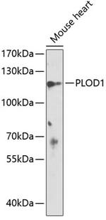 PLOD1 Polyclonal Antibody