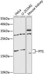 PTS Polyclonal Antibody