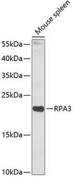 RPA14 Antibody in Western Blot (WB)