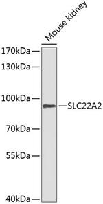SLC22A2 Polyclonal Antibody