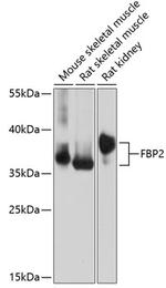 FBP2 Polyclonal Antibody