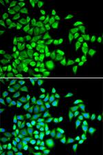 ABH1 Polyclonal Antibody