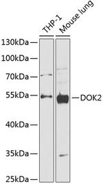 DOK2 Polyclonal Antibody