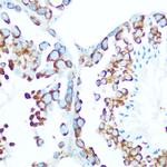 STIP1 Antibody in Immunohistochemistry (Paraffin) (IHC (P))