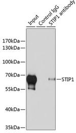 STIP1 Antibody in Immunoprecipitation (IP)